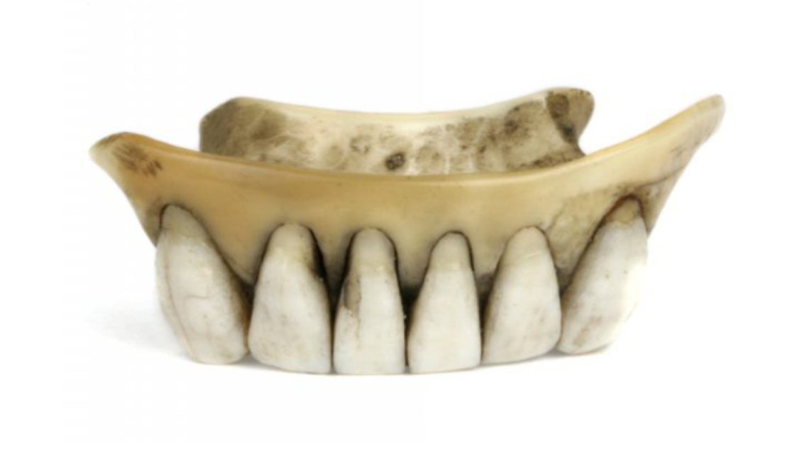 Dents de Waterloo, dentier ancien, histoire dentisterie